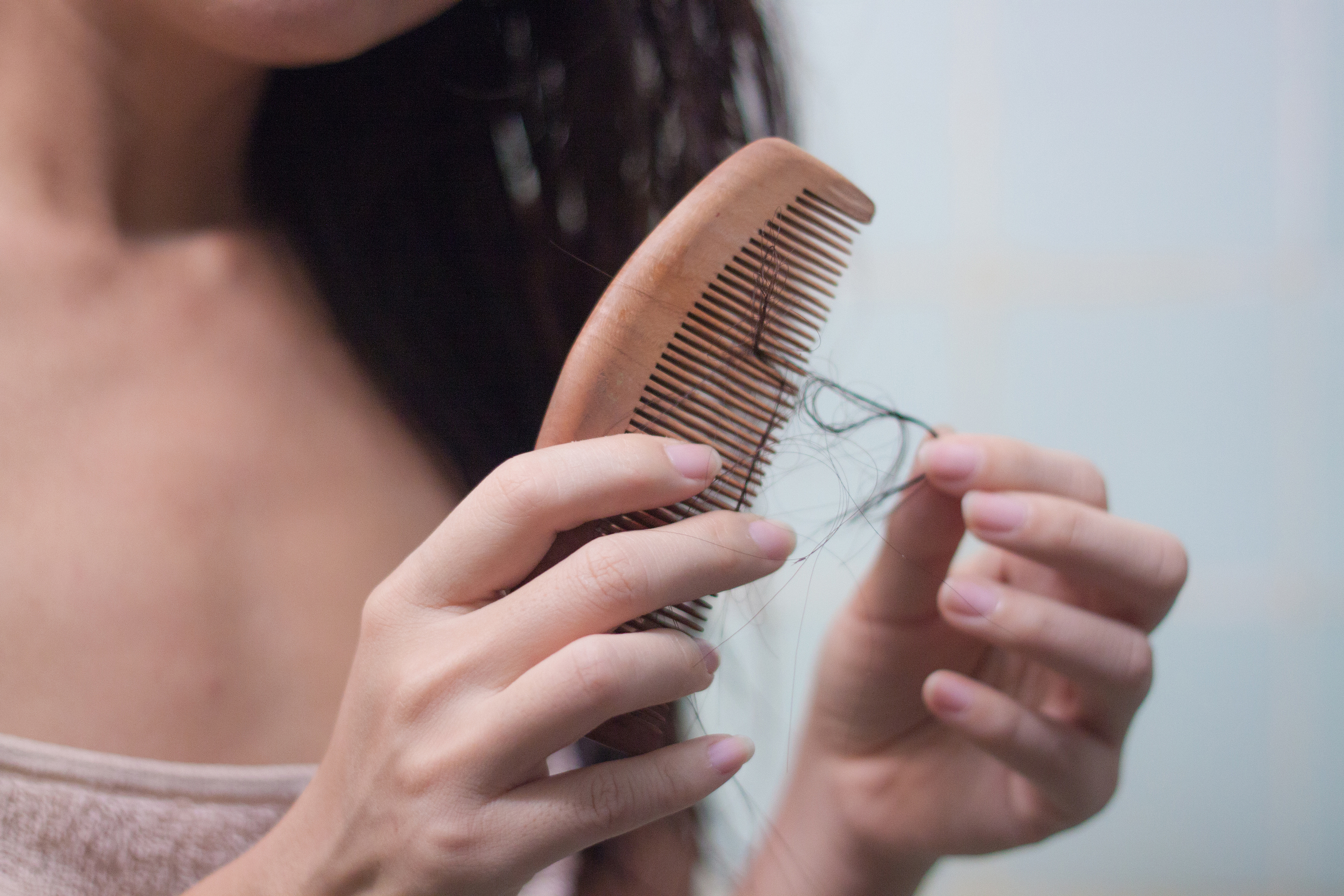 What Causes Female Hair Loss at Temples