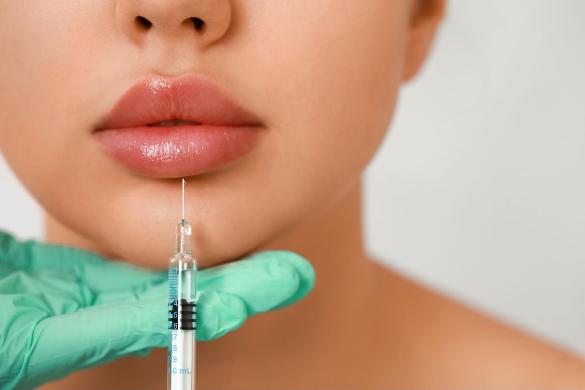 Lip Lifts and Lip Augmentation Options at CabinMD